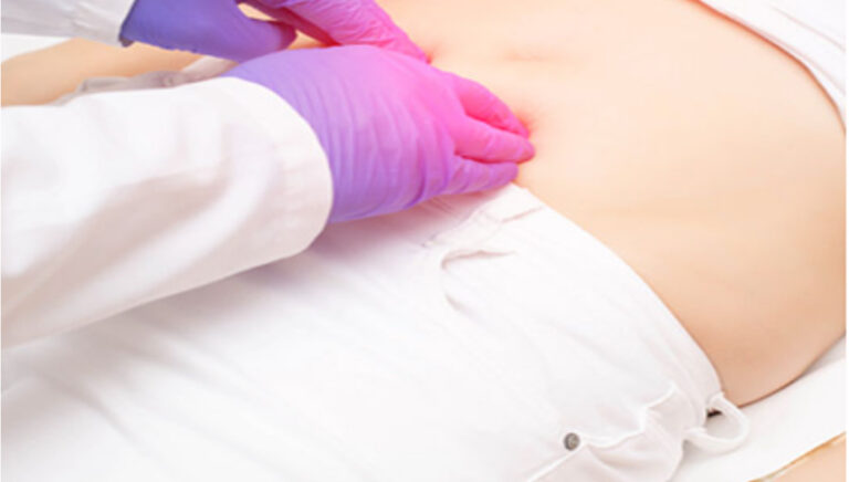 Complications of Untreated Hernia
