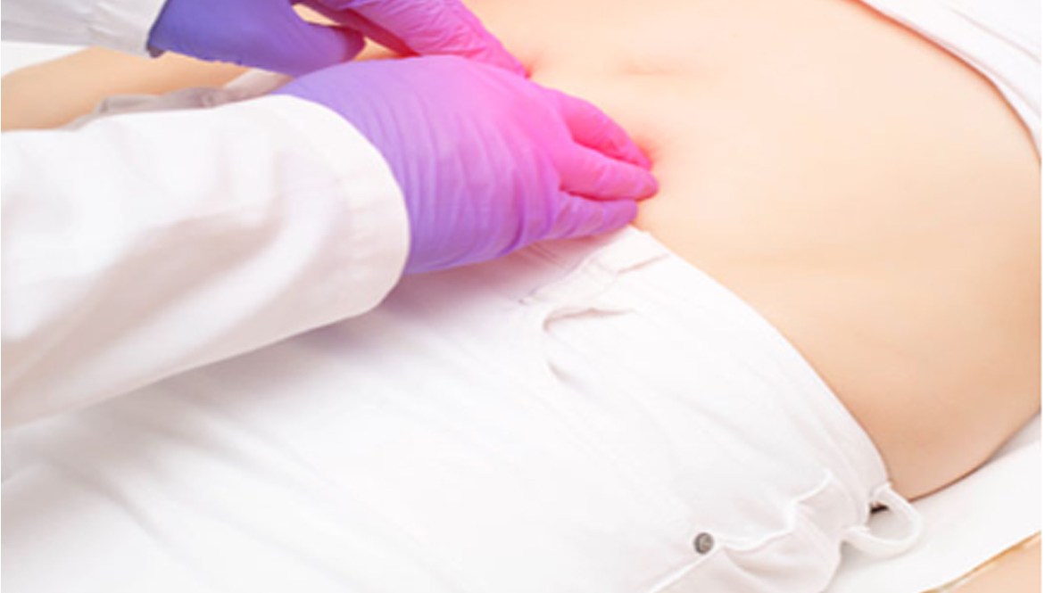 Complications of Untreated Hernia