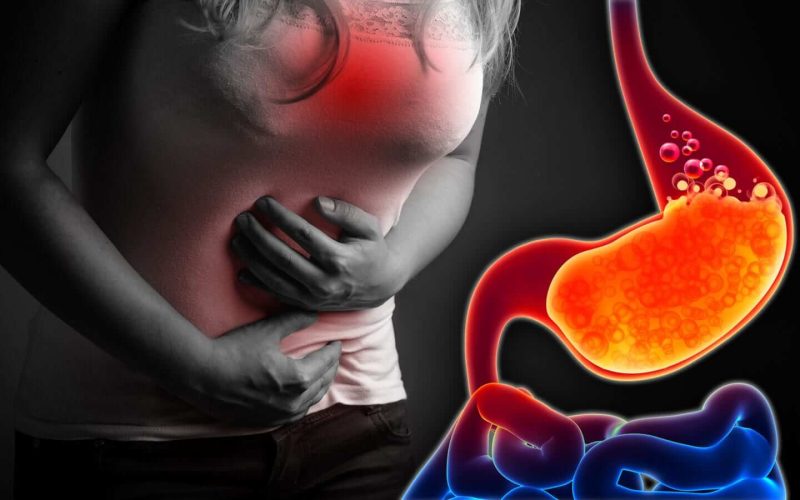 Unusual symptoms of GERD