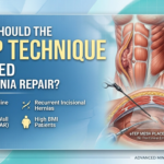 eTEP TECHNIQUE FOR HERNIA REPAIR
