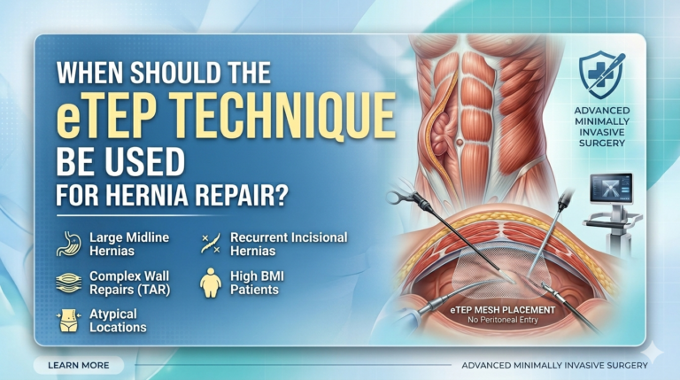 eTEP TECHNIQUE FOR HERNIA REPAIR