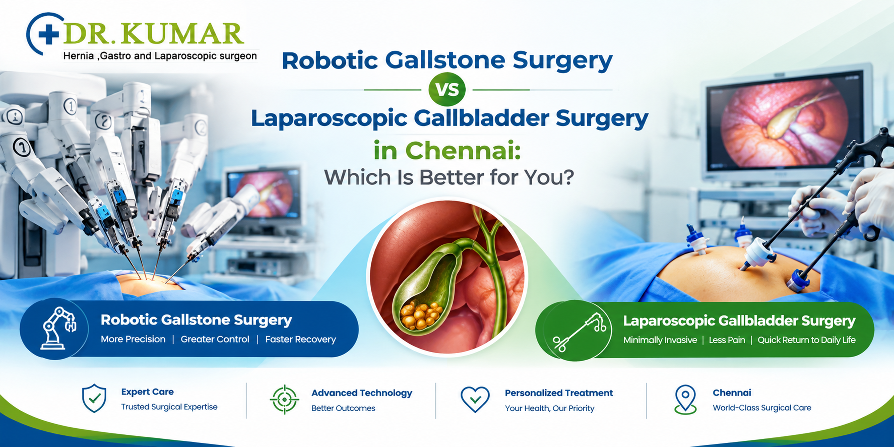 Robotic Gallstone Surgery vs Laparoscopic Gallbladder Surgery in Chennai: Which Is Better for You?